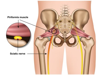 Piriformis Muscle Diagram